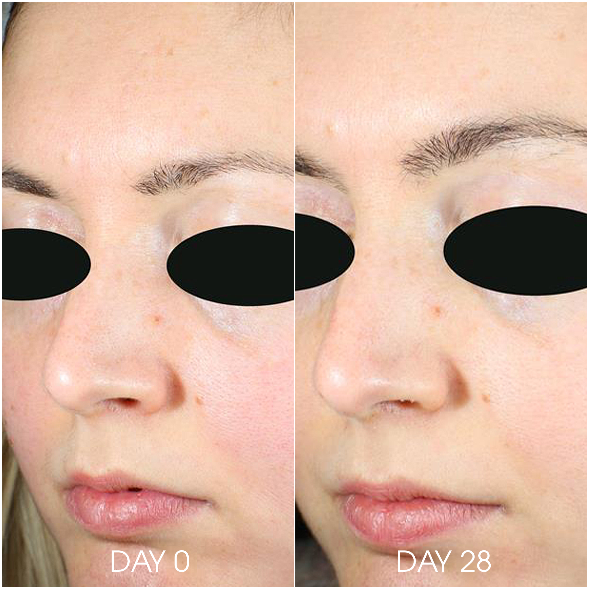 Active Microscrub